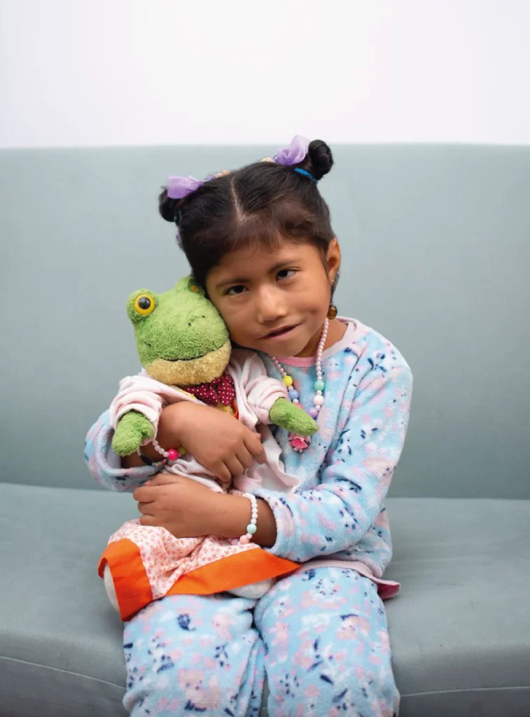 Moebius rehabilitación